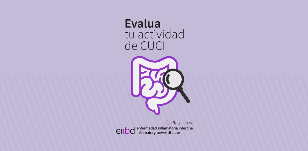 EIIBD-Imagen-Actividad en CUCI